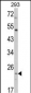 ATP5O Antibody (N-term)